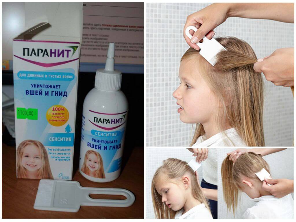 Как убрать из волос гниды - wikihow
