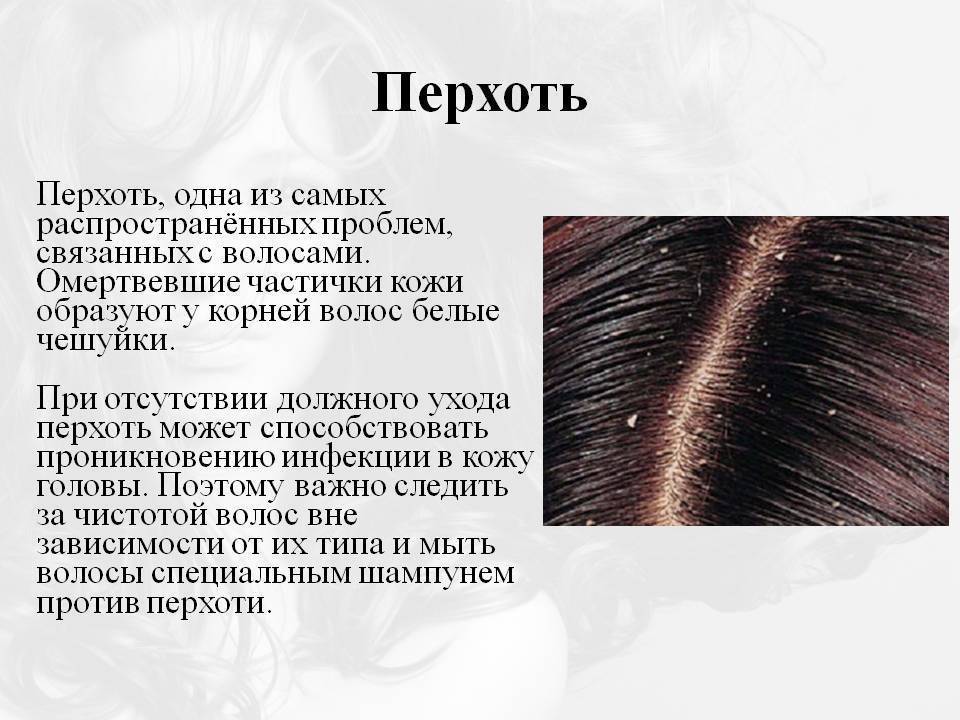 Как избавиться от перхоти во время беременности?