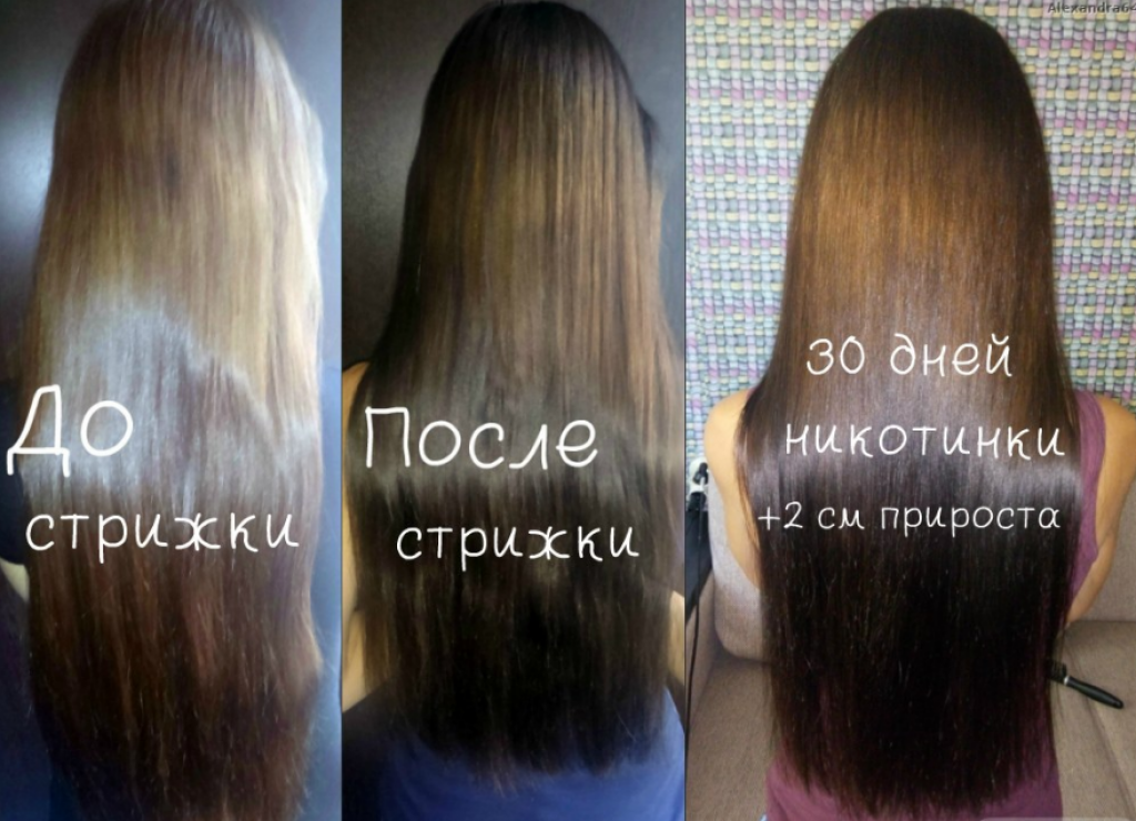 Никотиновая кислота от выпадения и для роста волос | volosomanjaki.com