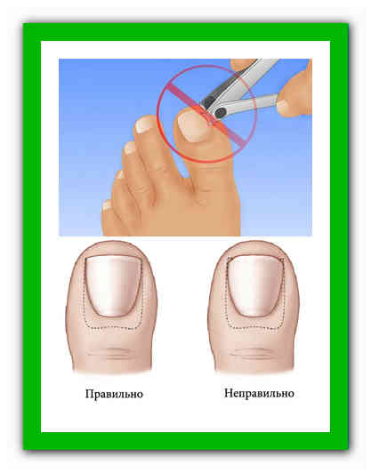 Как правильно стричь ногти