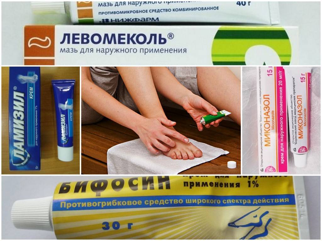 Мазь от грибка: список лучших недорогих средств для лечения микоза