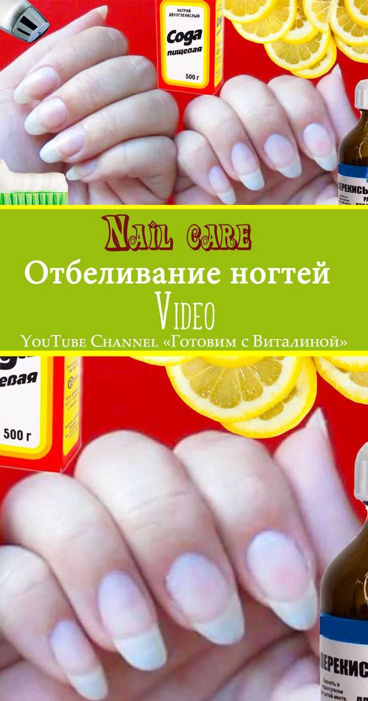Как отбелить ногти в домашних условиях – лучшие методы