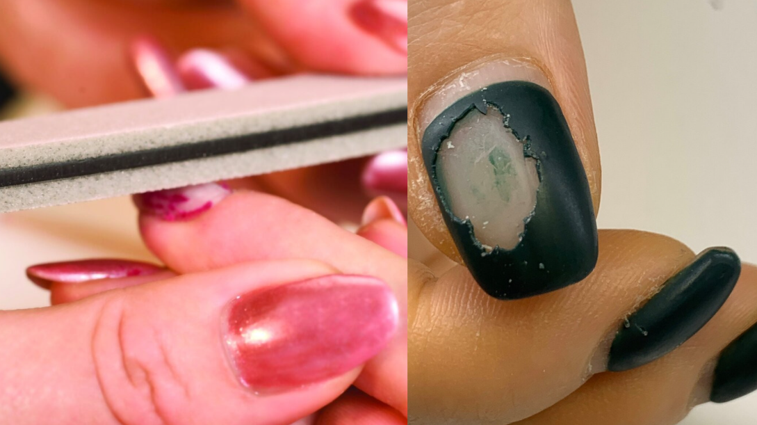 Гель-лак не держится на ногтях: основные причины, что делать? - modnail.ru - красивый маникюр