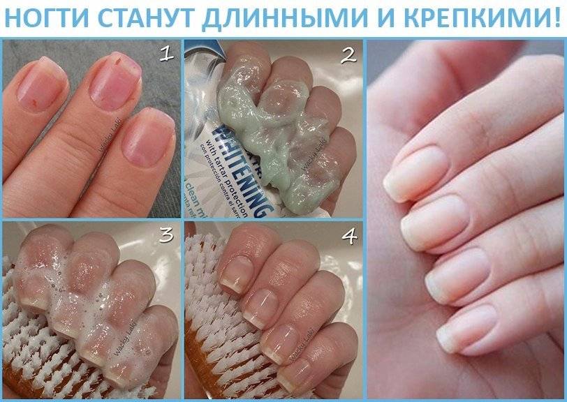 Как можно быстро отрастить ногти