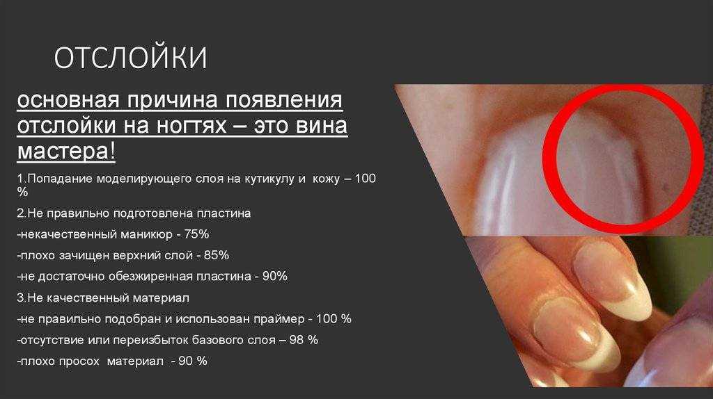 Почему слоятся ногти на ногах