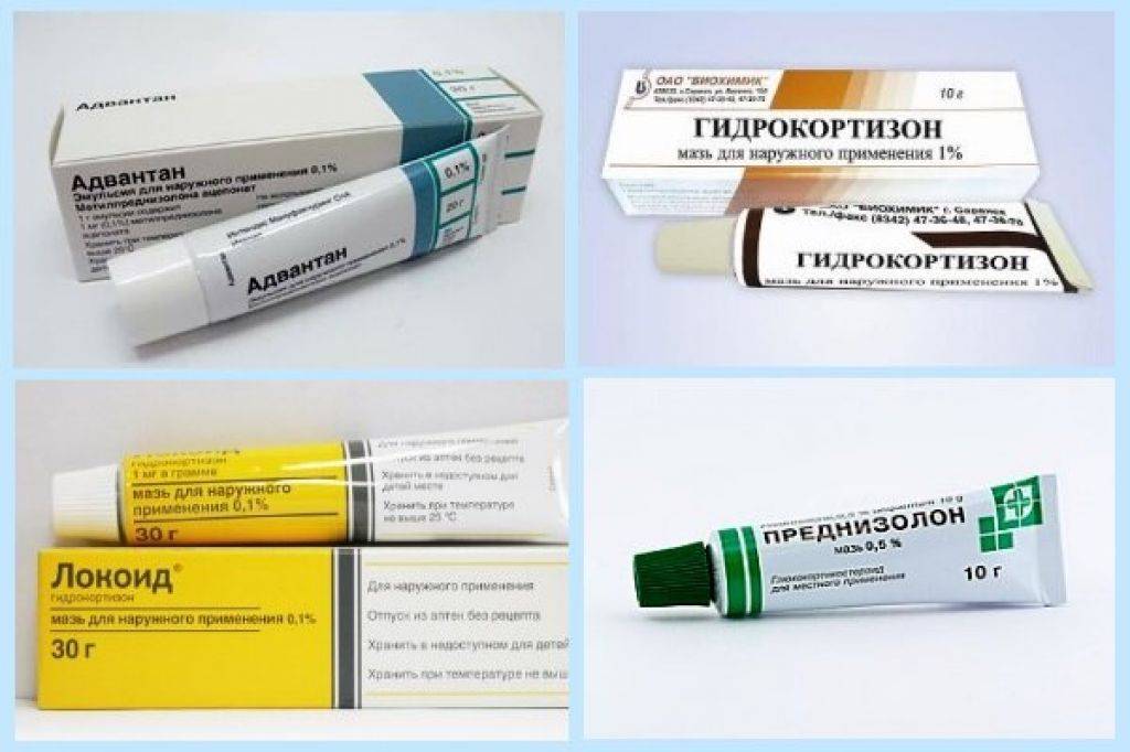 💊лучшие негормональные мази от псориаза на 2024 год