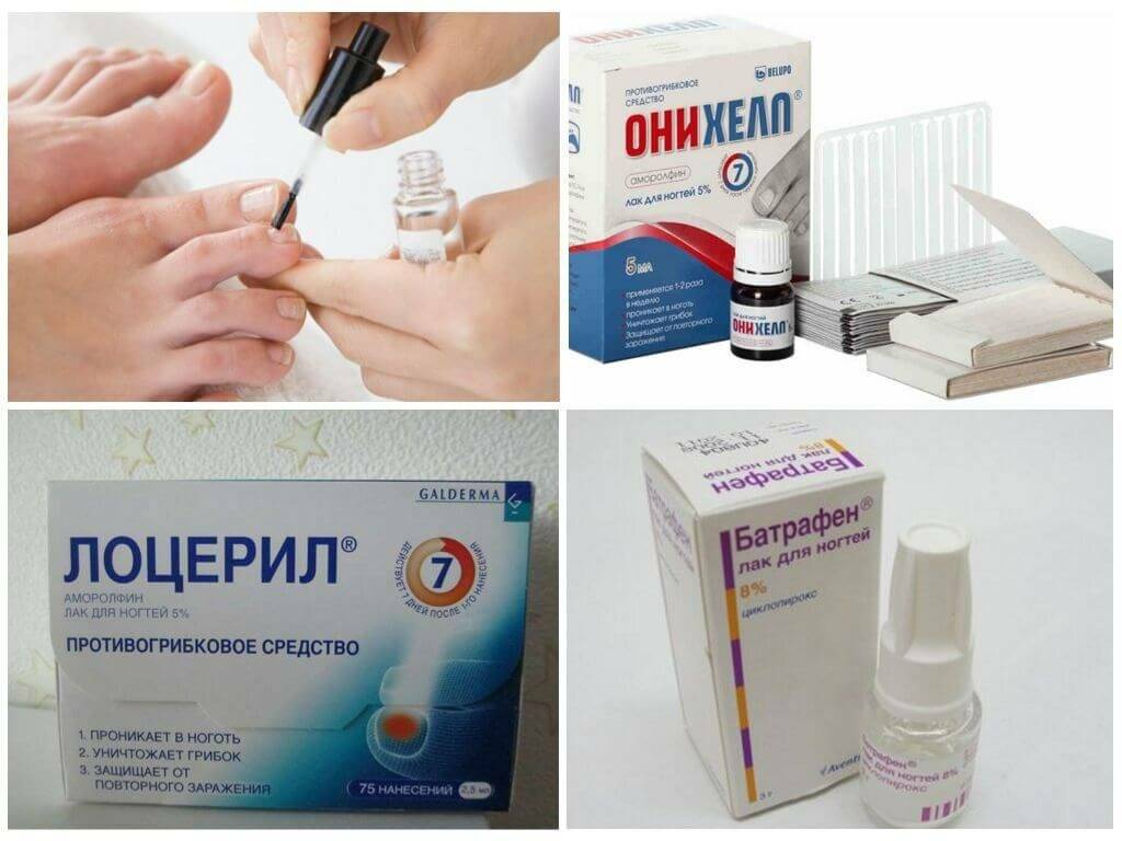 12 лучших средств от грибка ногтей