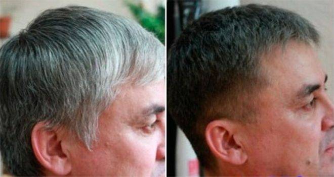 Камуфляж седины для мужчин: что это такое и как проводится