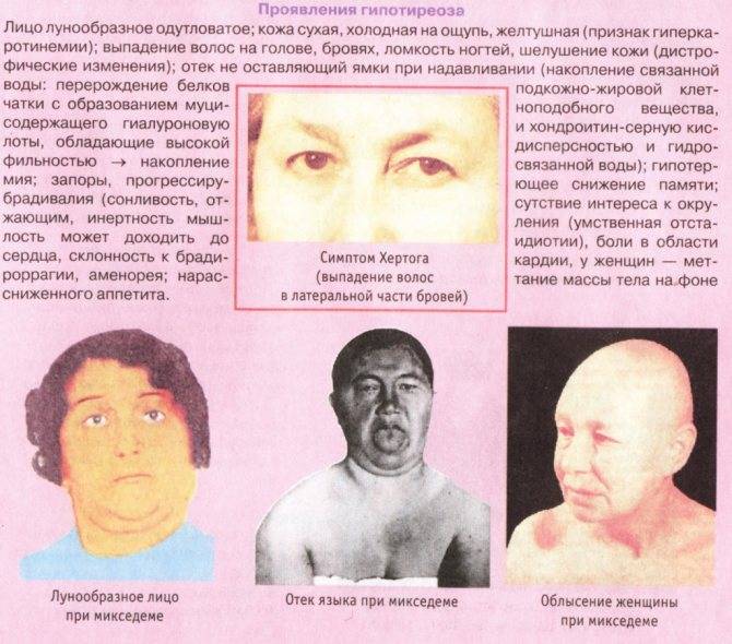 Выпадение волос у женщин: причины – щитовидка, подробный курс лечения!