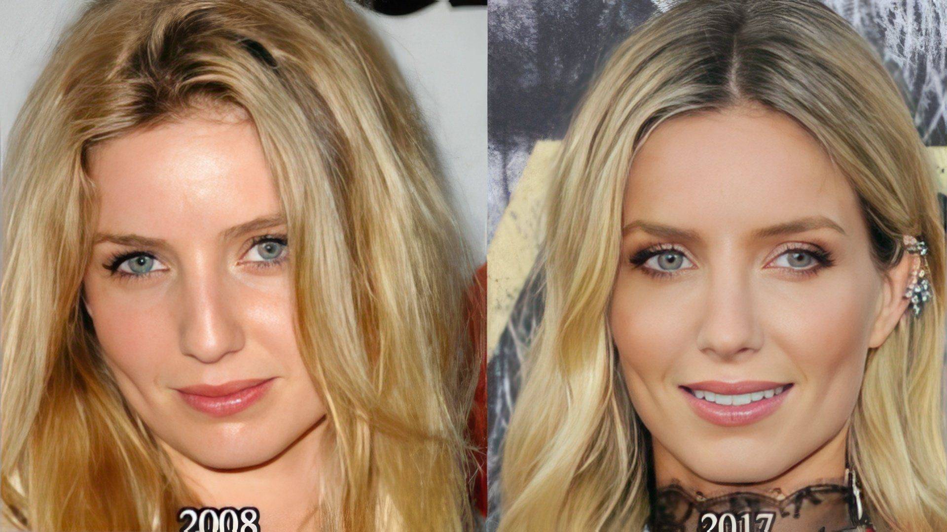 Annabelle wallis nose job plastic surgery before and after photos - latest plastic surgery gossip and news. plastic surgery tips and advice