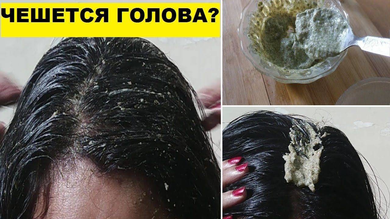 Как бороться и что делать с жирными волосами в домашних условиях: причины возникновения и рецепты лечения