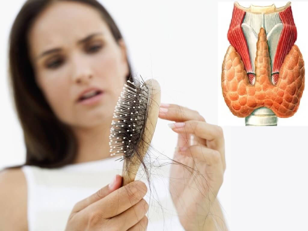 ▷ гипотиреоз и выпадение волос, это обратимо? – clinicana