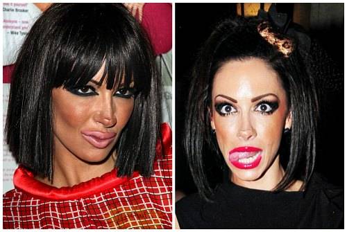 Jodie marsh nose job