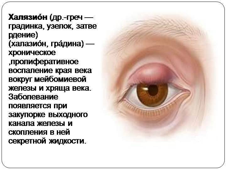 Припухлость под глазом: что это может быть, причины симптома, способы устранения отека левого или правого нижнего века