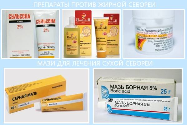 Лечение себорейного дерматита кожи головы шампунями, лекарствами и народными средствами