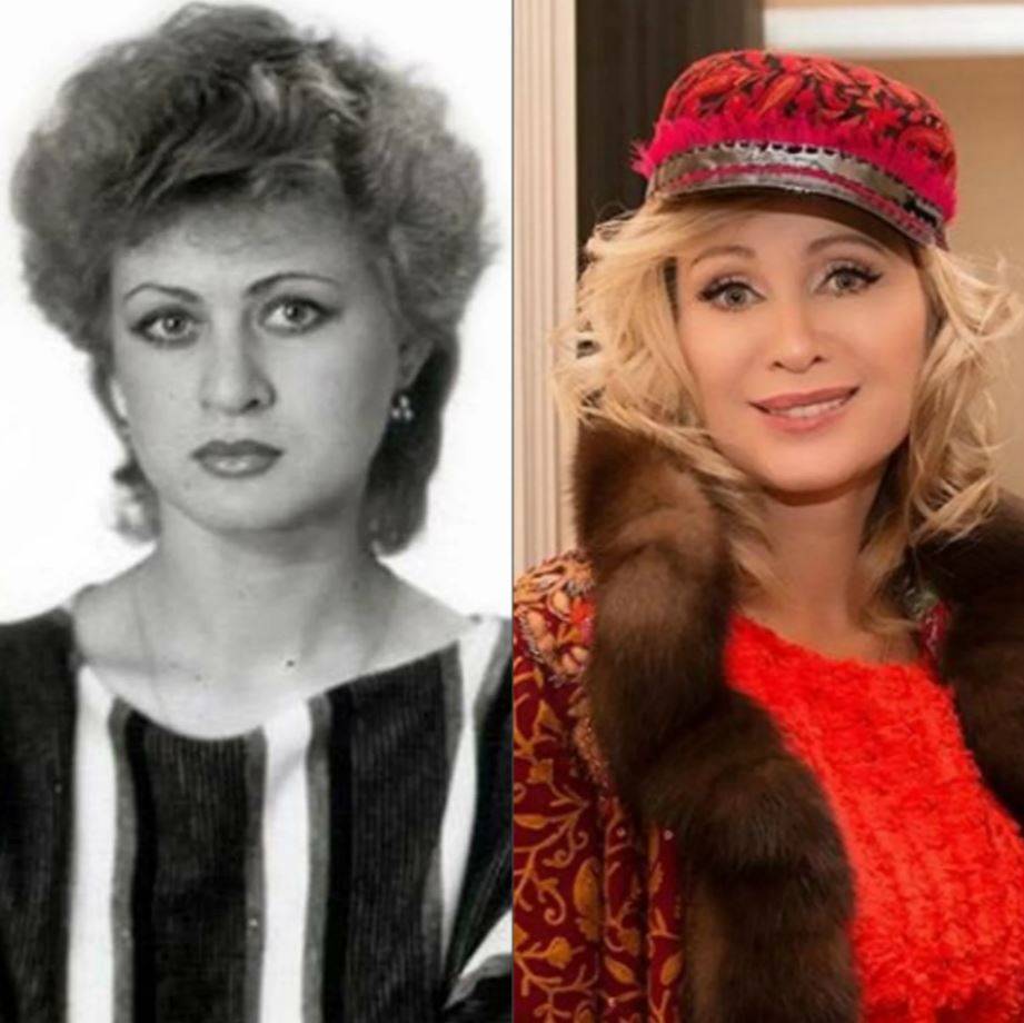 Как помолодела вика цыганова: фото до и после пластики. фото вики цыгановой до и после пластики