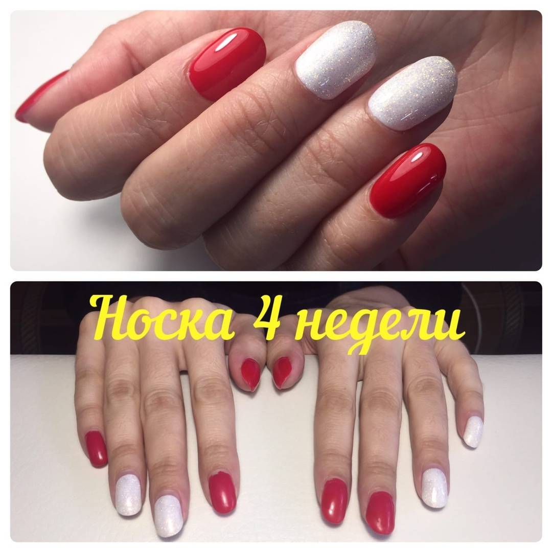 Гель-лак: красота, которая не стоит таких жертв