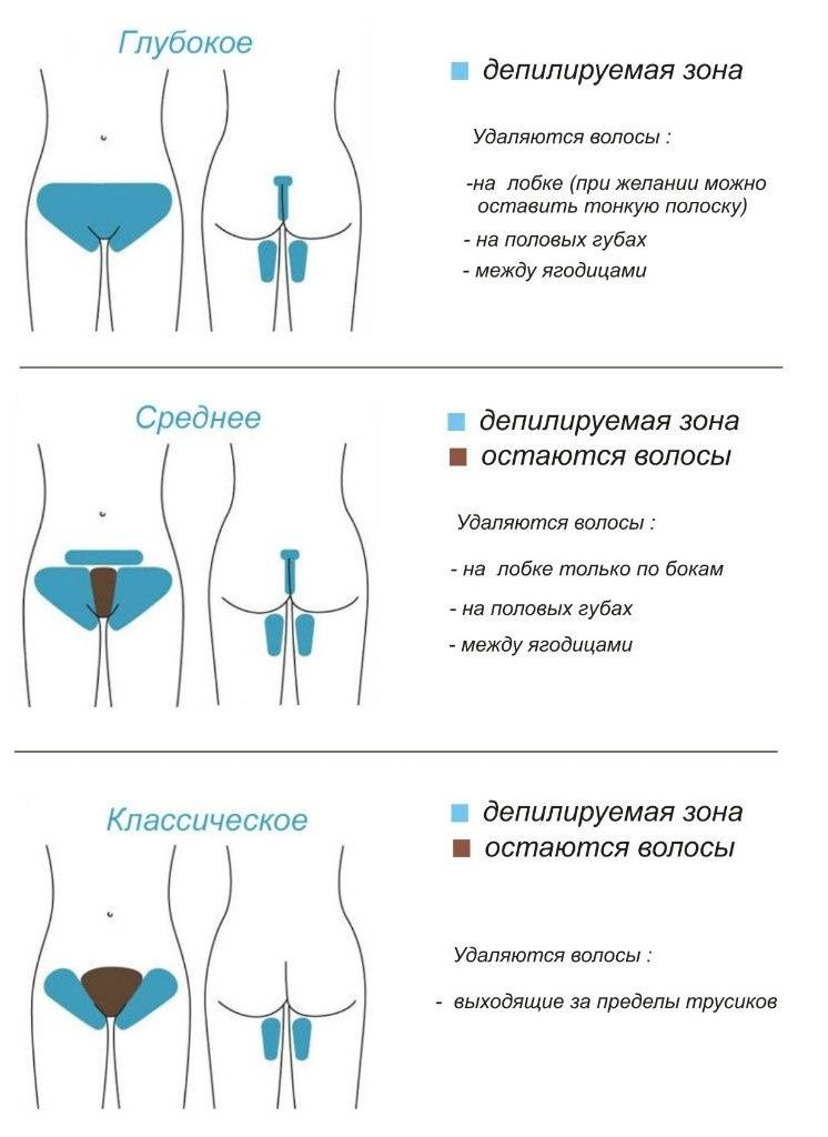 Как делают шугаринг глубокого бикини