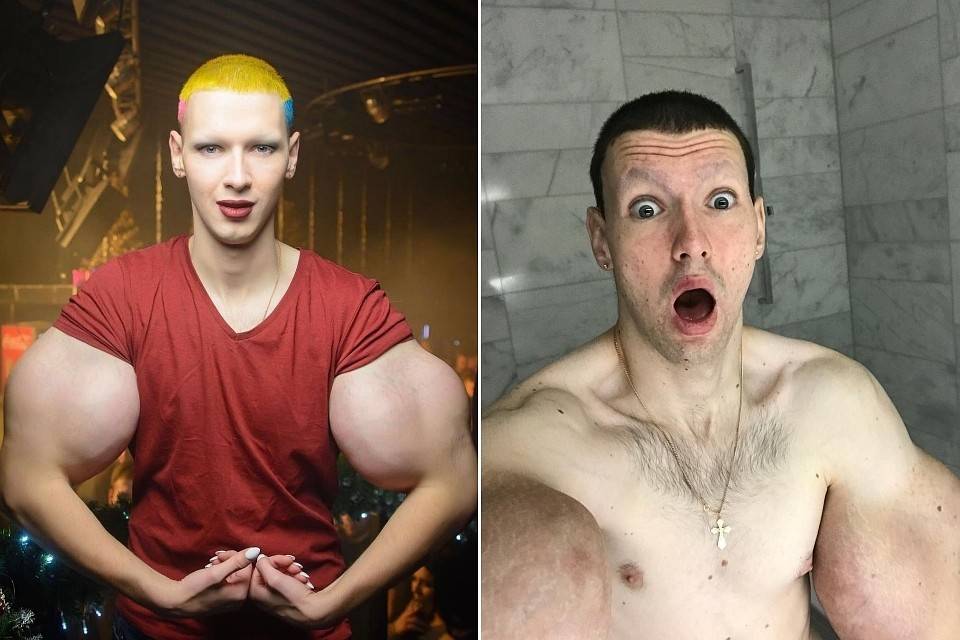 Синтольщик кирилл терешин, сейчас что с ним? недавние события.