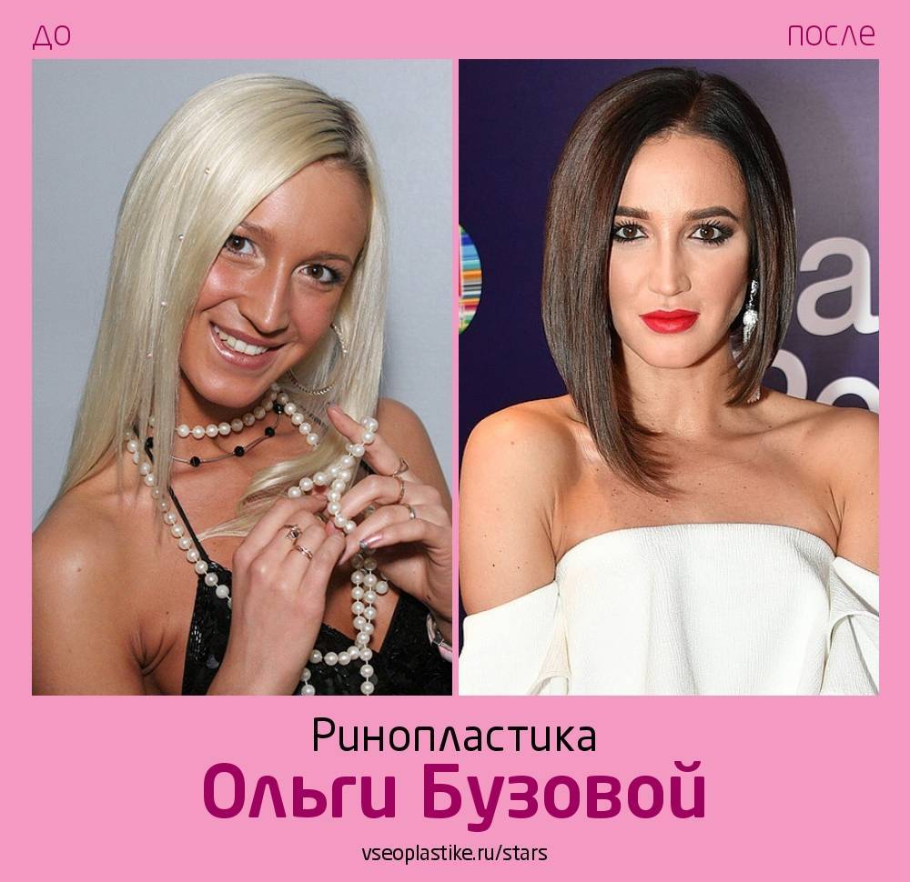 Ольга бузова- пластические операции, биография, личная жизнь