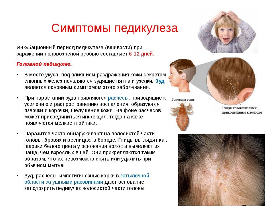 Вши у беременной: что делать в непростой ситуации