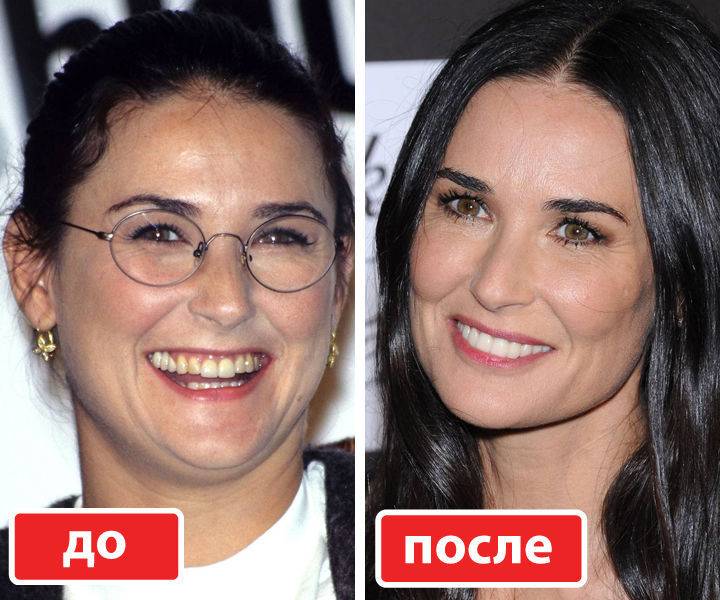 Деми мур до пластики, после первой и последней
