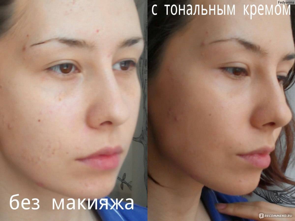 Особенности процедуры bb glow и тонкости ухода за кожей после сеанса