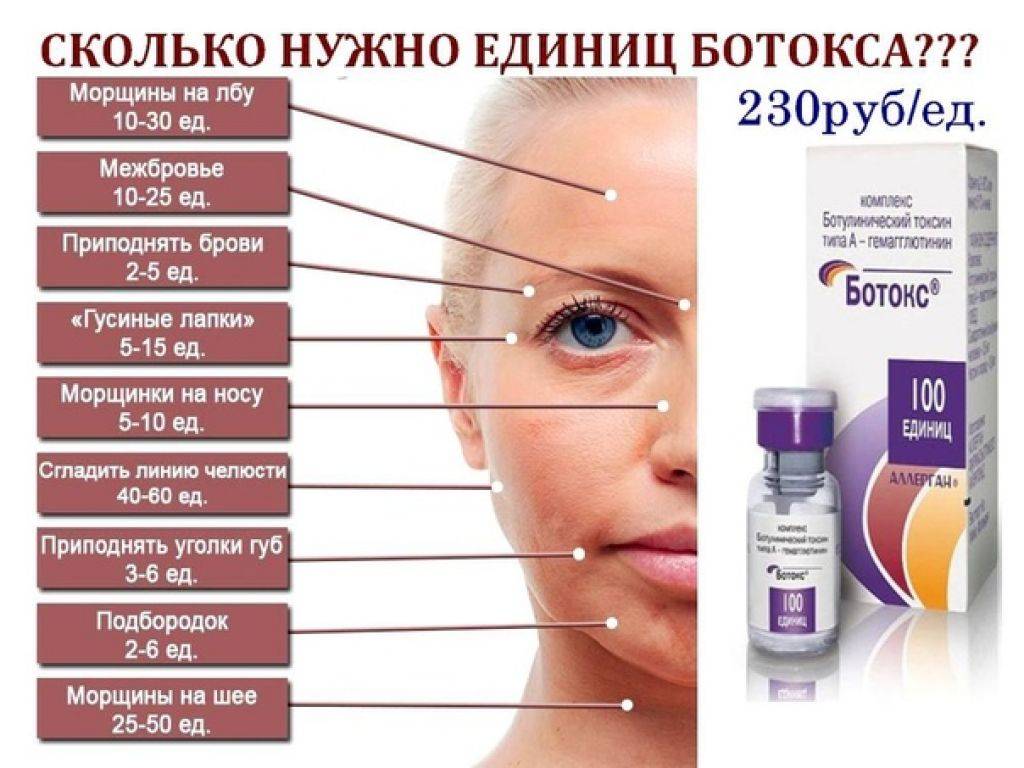 Инъекционный ботокс refinex: темная лошадка на косметологическом рынке