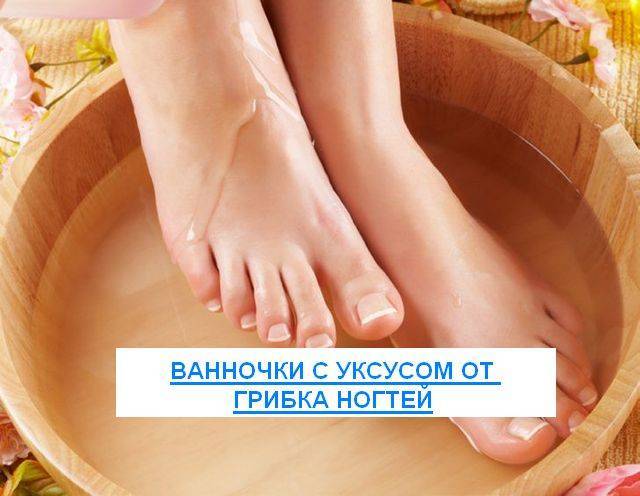 Грибок ногтей: лечение уксусом, включая яблочный, причины, симптомы заболевания на ногах и руках, и нужно ли в борьбе против онихомикоза добавлять соду в лекарство?