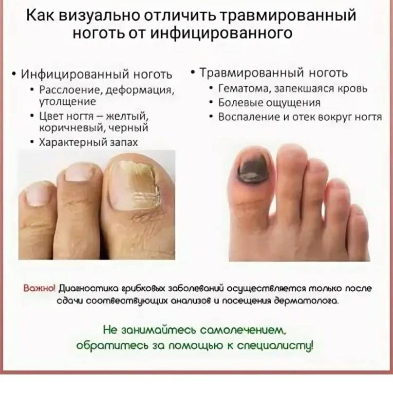 Как стричь ногти? учим подростка