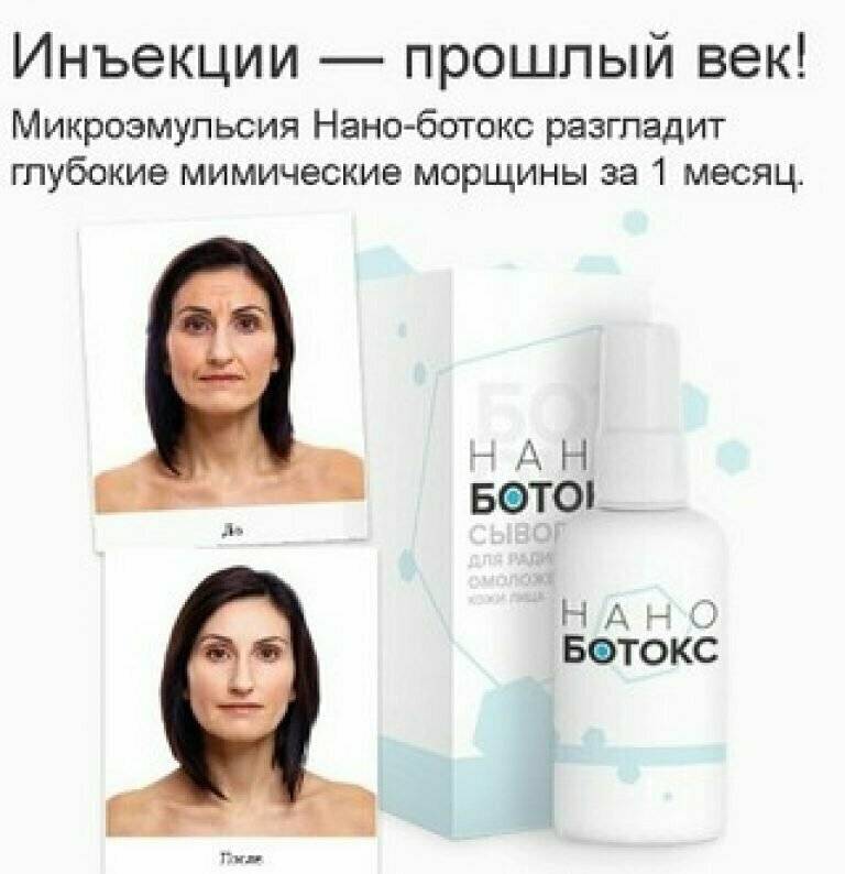 Нано ботокс: реальный эффект от препарата, свойства и плюсы (2021)