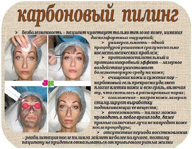 Сделать лазерный карбоновый пилинг выгодно