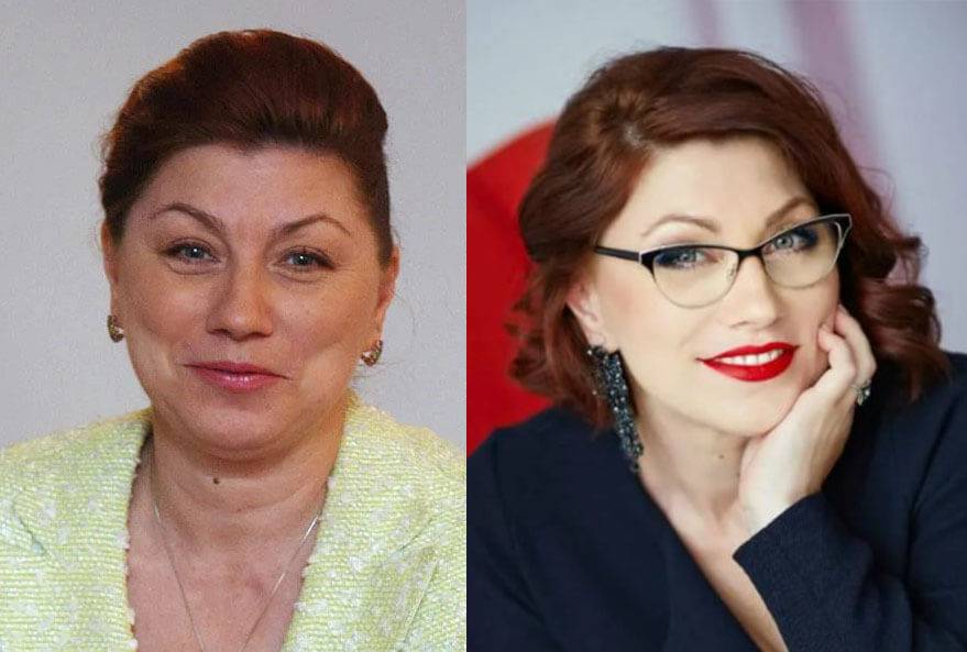 Пластические операции розы сябитовой: фото до и после