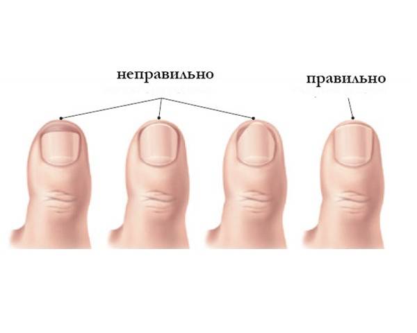 Как правильно подпиливать ногти: пошаговая инструкция и различные формы