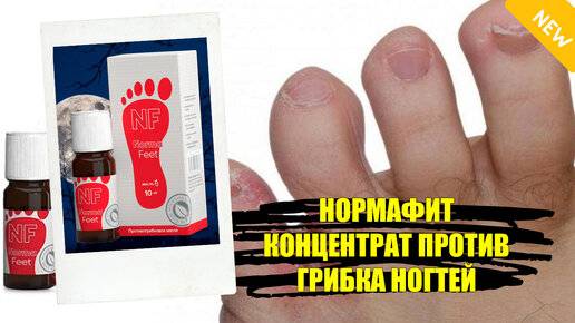 Лучшие мази от грибка ногтей: как выбрать эффективную