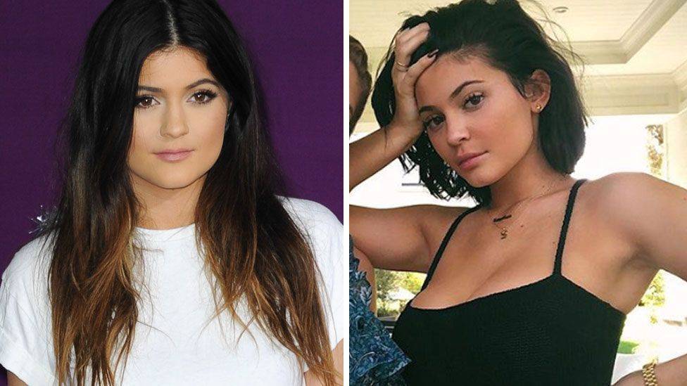Kylie jenner before and after plastic surgery journey