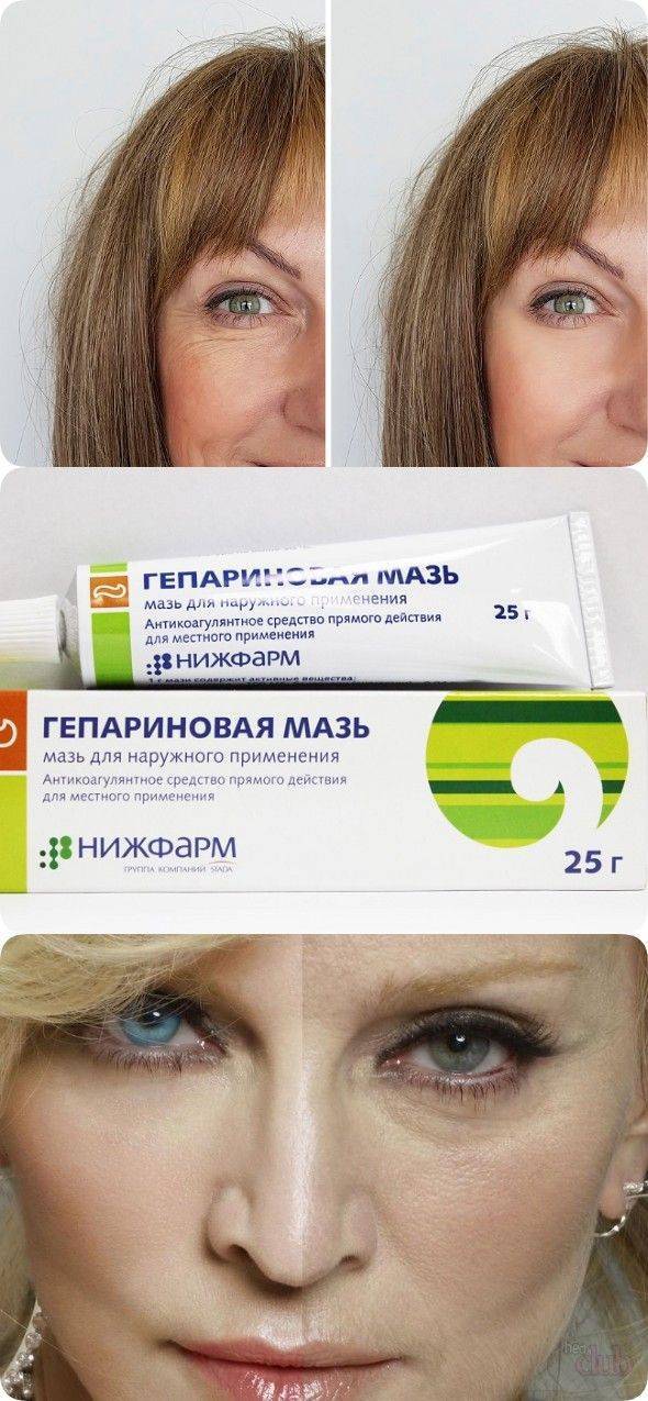 Стоит ли применять гепариновую мазь от морщин под глазами — отзывы врачей помогут ответить
