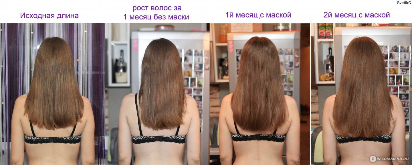 Отвечаем на вопрос на сколько см вырастают волосы за месяц