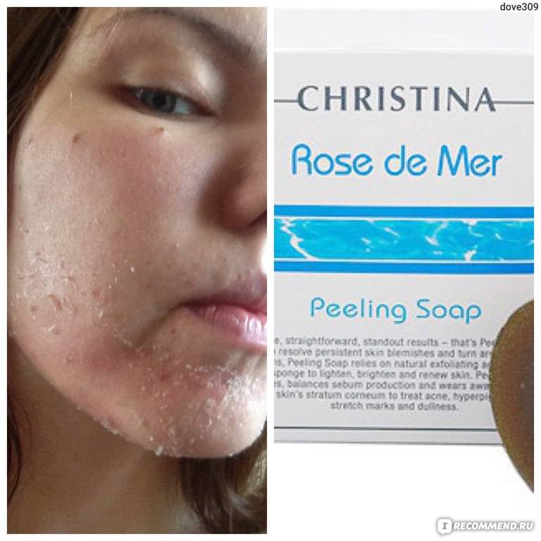 Коралловый пилинг кристина роз де мер (rose de mer christina), фото до и после * в домашних условиях для лица