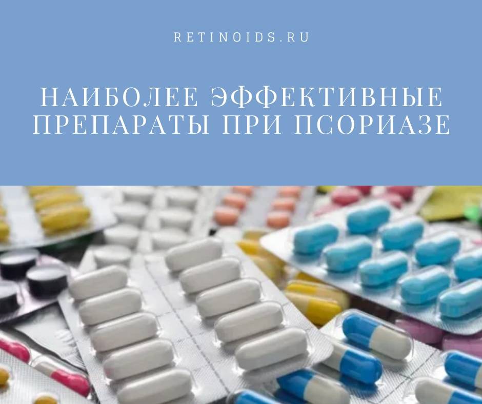 Витамин д при псориазе: как принимать, дозировка, схема