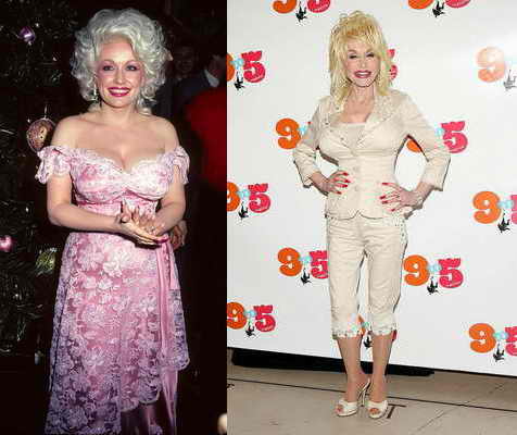 Dolly parton's plastic surgery: all the work she's gotten done over the years