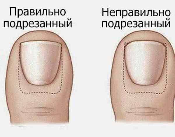 Как сделать педикюр в домашних условиях самой себе в 2023 году: пошагово с 50+ фото и видео