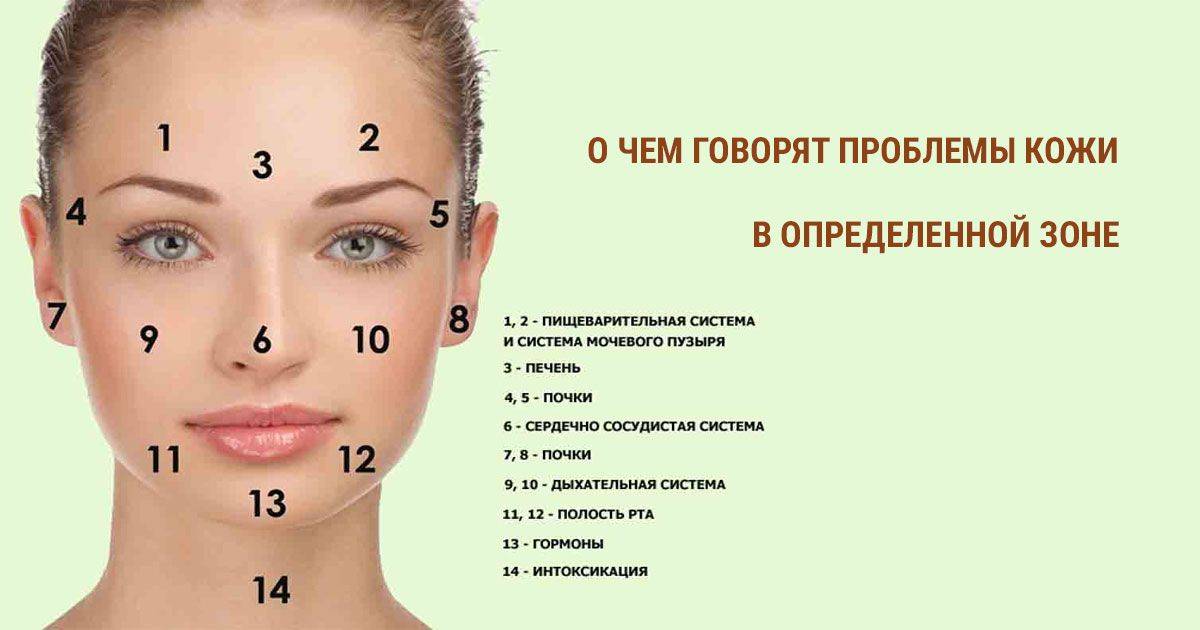 Прыщи на подбородке у женщин: причины, какой орган не в порядке, лекарства и препараты