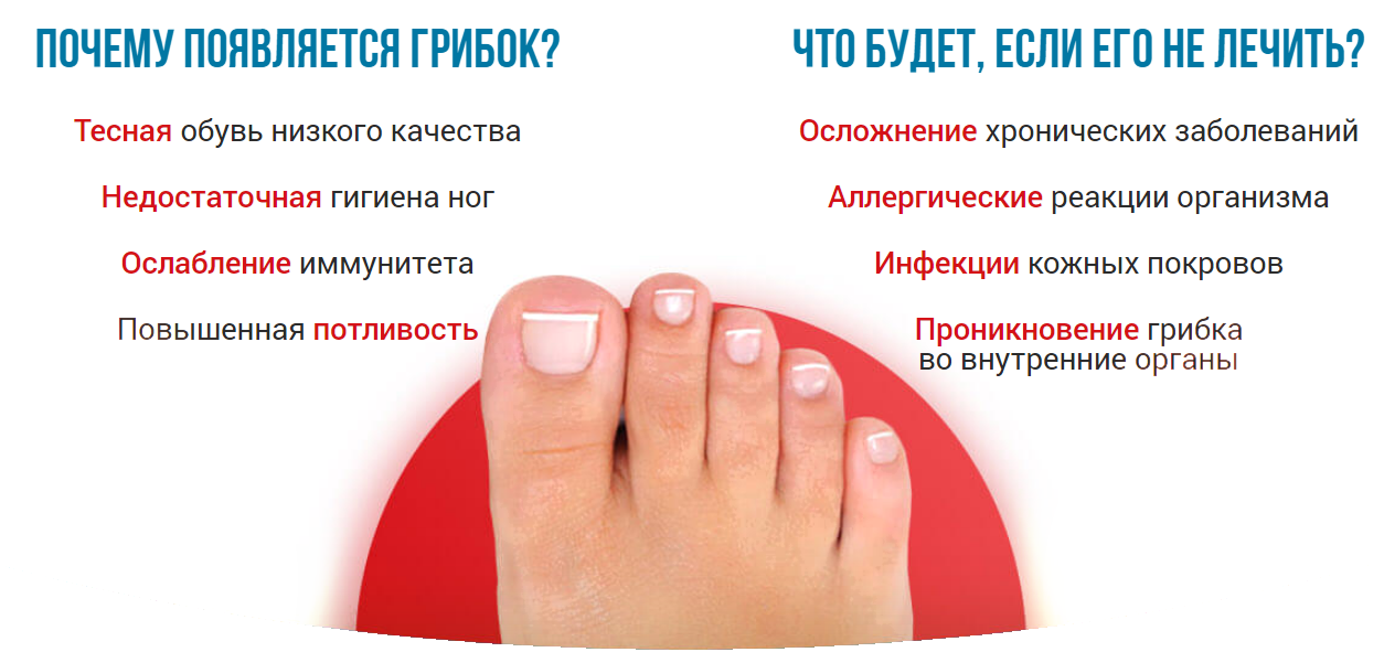 Вросший ноготь на ноге: лечение в домашних условиях, удаление вросшего ногтя, что делать, если врастает ноготь на большом пальце