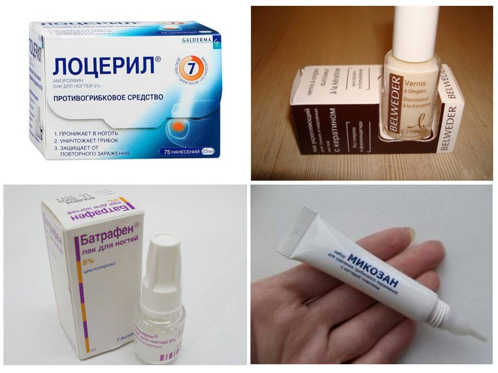 Таблетки от грибка ногтей: недорогие но эффективные