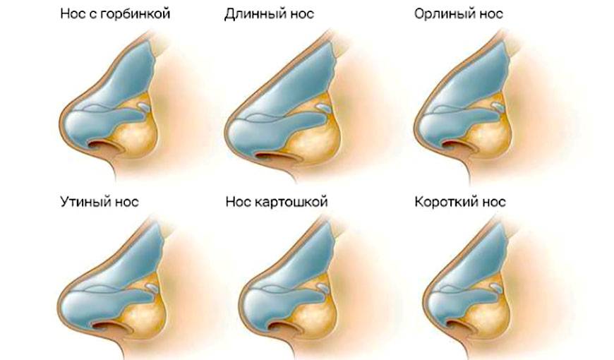 Острый нос, классический, римский, вздернутый, картошкой, тонкий - какой нос красивый и правильный и что можно сказать о характере обладателя определенной формы носа