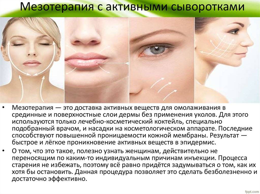 Мезотерапия: что это за процедура, как она проводится, эффект от процедуры - косметология бьютимед
