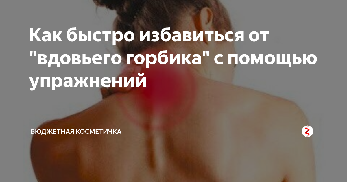 Доктор бубновский: как убрать вдовий горб. лучший способ!