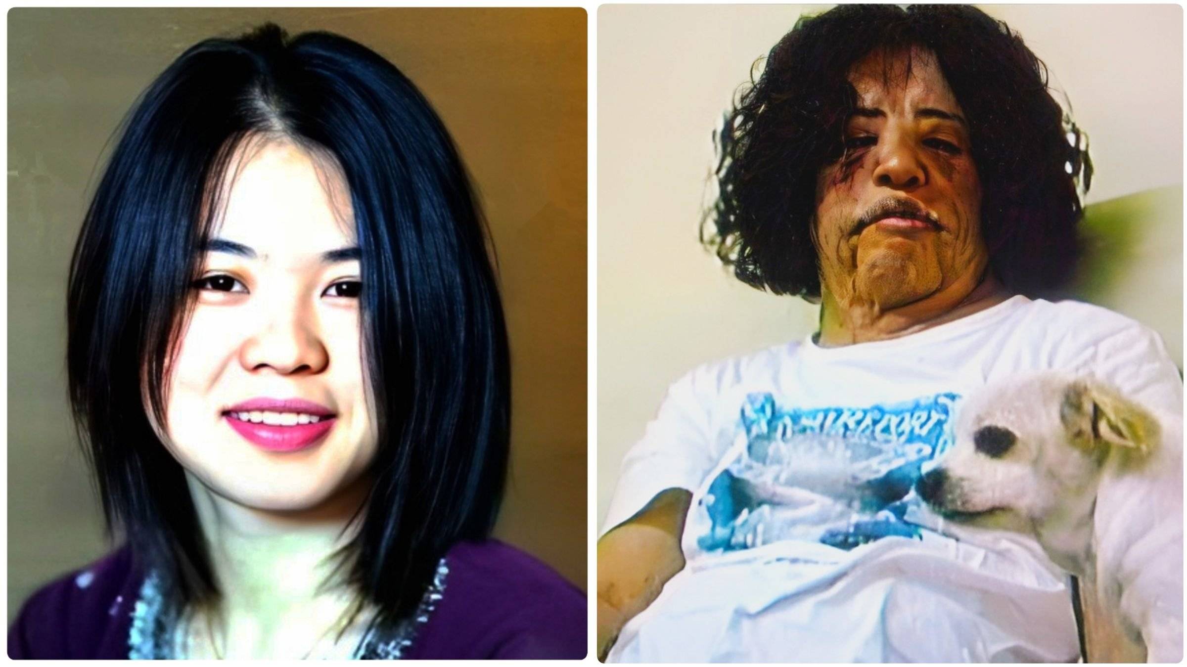 Korean model hang mioku's ugly transformation after surgeries