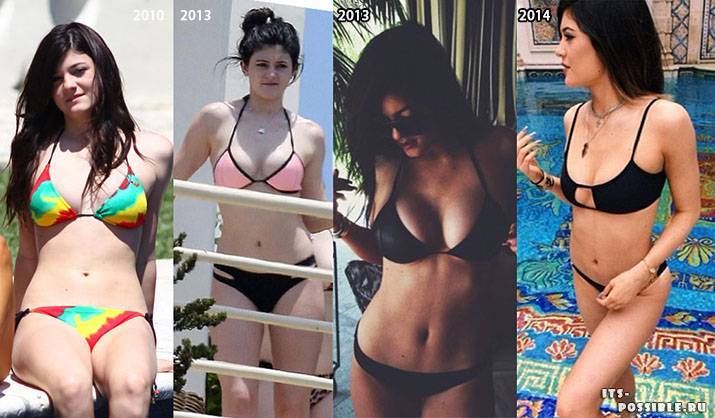 Kylie jenner, before and after transformation